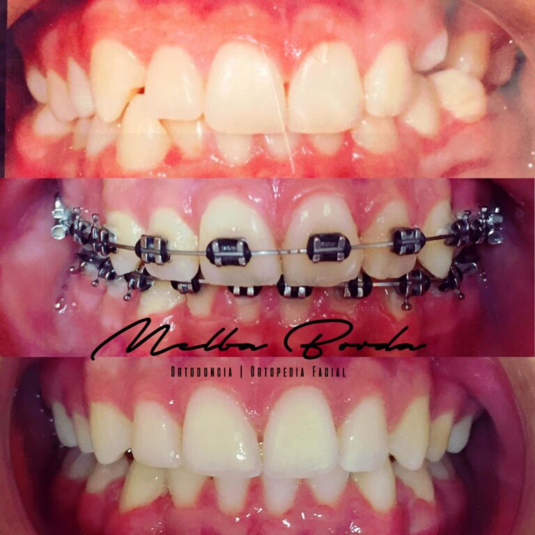 Dra. Melba Borda-im├ígenes-3