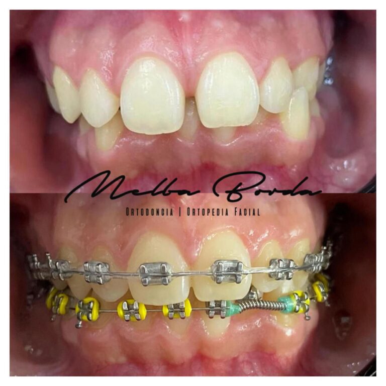 Dra. Melba Borda-im├ígenes-5